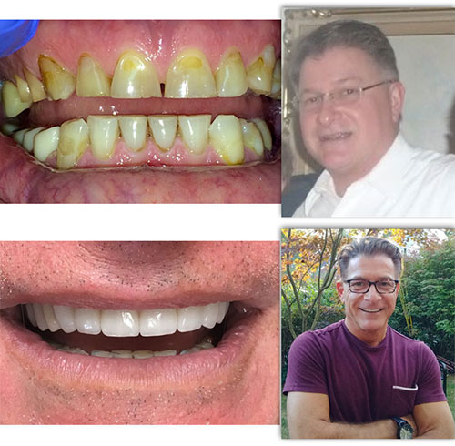 Joe Before/After