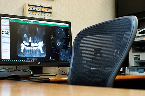 Dental Cone Beam CT