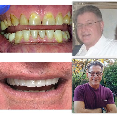 Joe Before/After