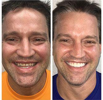 Smile Gallery of Happy Patients