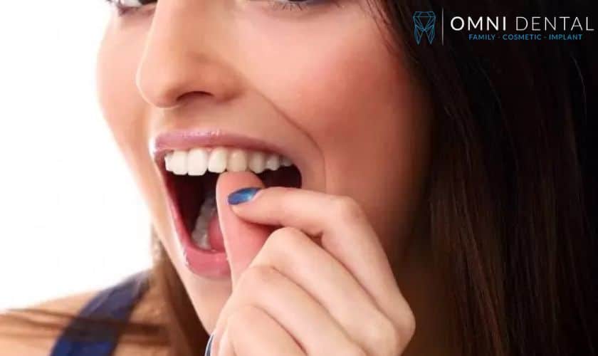 Can-I-Eat-After-A-White-Filling