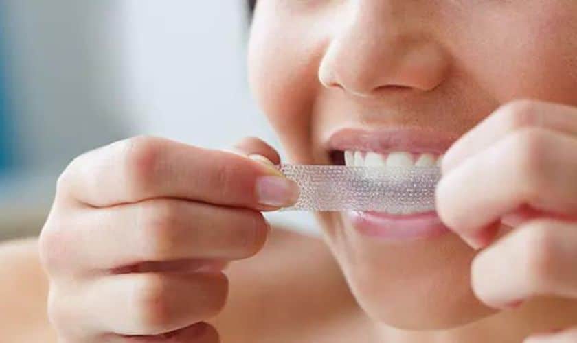 teeth whitening strips