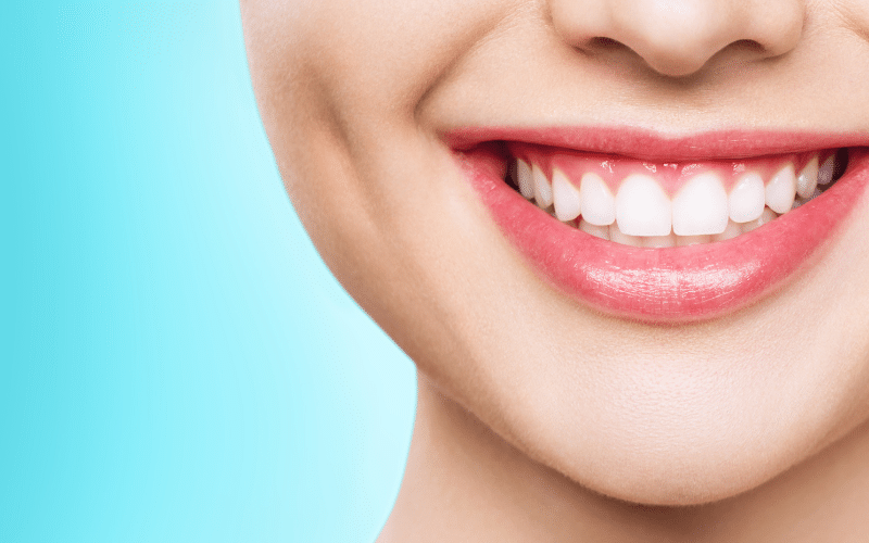 Cosmetic Dental Procedure