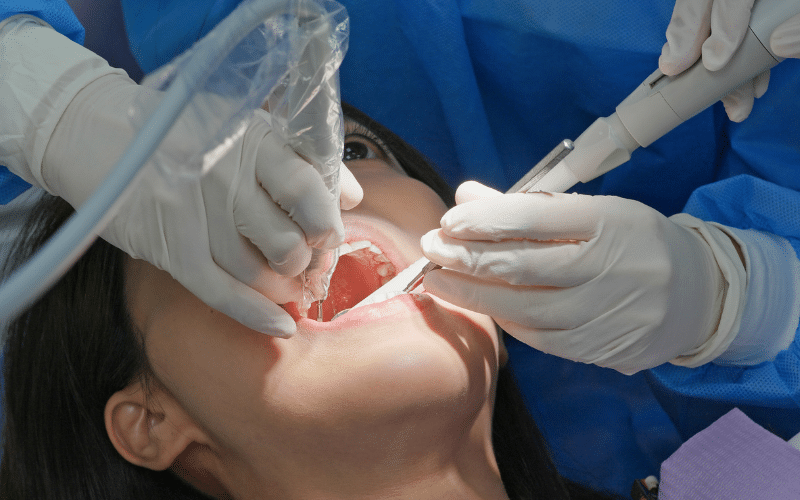 root canal treatments