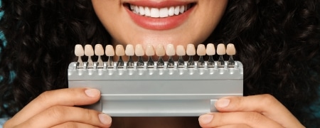 How Do Teeth Look Post Dental Veneer Treatment?