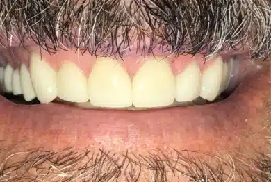 Dental Success Stories Backup Dont delete please 2