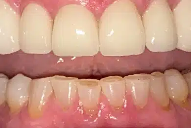 Dental Success Stories Backup Dont delete please 2