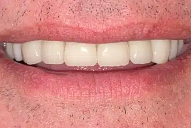 Dental Success Stories Backup Dont delete please 2