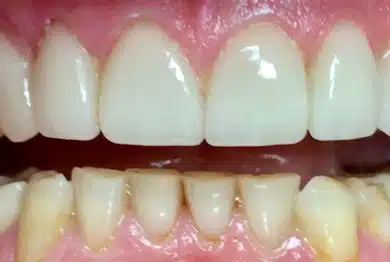 Dental Success Stories Backup Dont delete please 2