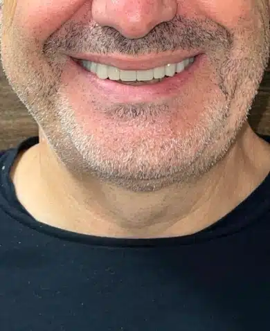 Dental Success Stories Backup Dont delete please 2