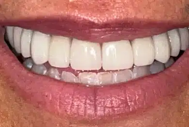 Dental Success Stories Backup Dont delete please 2