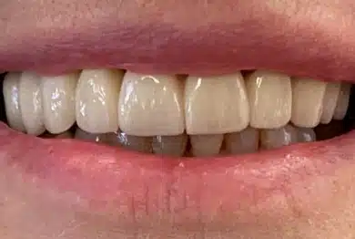 Dental Success Stories Backup Dont delete please 2