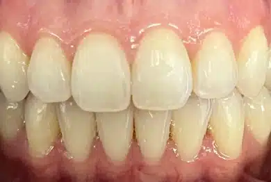 Dental Success Stories Backup Dont delete please 2