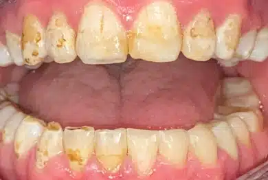 Dental Success Stories Backup Dont delete please 2
