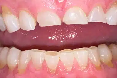 Dental Success Stories Backup Dont delete please 2