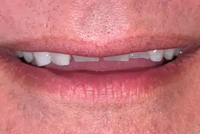 Dental Success Stories Backup Dont delete please 2