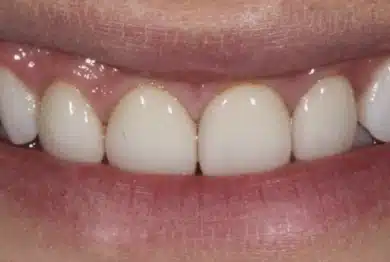 Dental Success Stories Backup Dont delete please 2