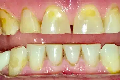 Dental Success Stories Backup Dont delete please 2