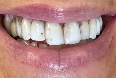 Dental Success Stories Backup Dont delete please 2