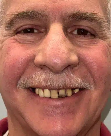 Dental Success Stories Backup Dont delete please 2