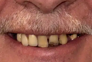 Dental Success Stories Backup Dont delete please 2