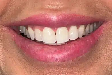 Dental Success Stories Backup Dont delete please 2