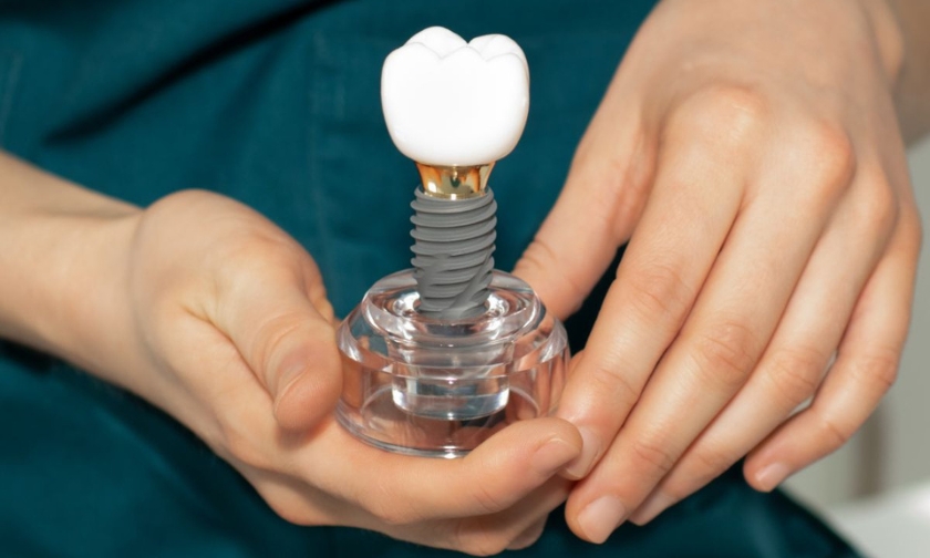 dental implants in pittsburgh