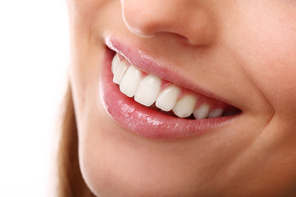 How Does Diet Impact Teeth Whitening Results?